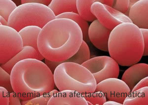 La anemia es una afectación hemática